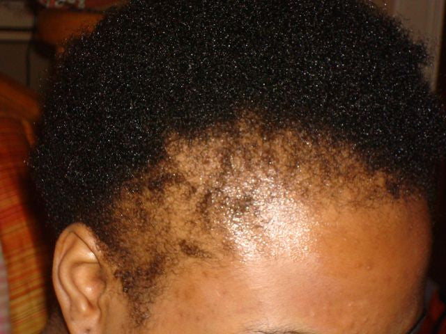 4 Easy Ways to Protect your Edges